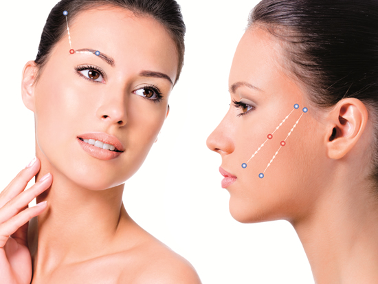 Sutura-silhouette-tecnica-rejuvenescimento-facial