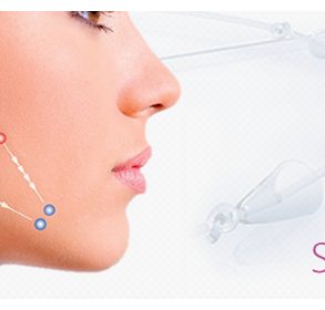 sutura-silhouette-tecnica-rejuvenescimento-facial