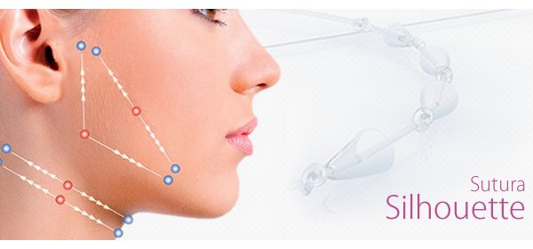 sutura-silhouette-tecnica-rejuvenescimento-facial