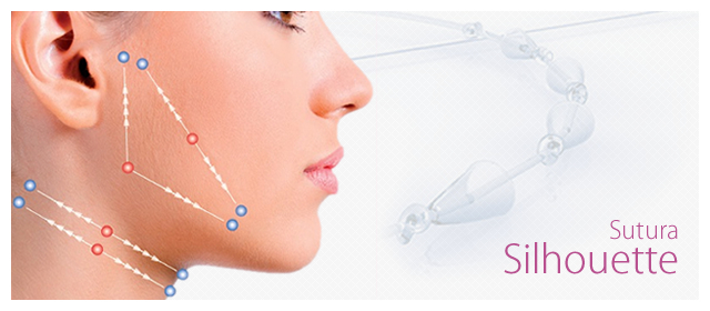 sutura-silhouette-tecnica-rejuvenescimento-facial